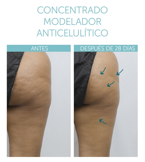 Concentré de Modelage Cellulite 3